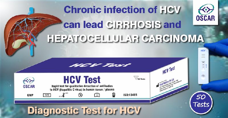 hcv test