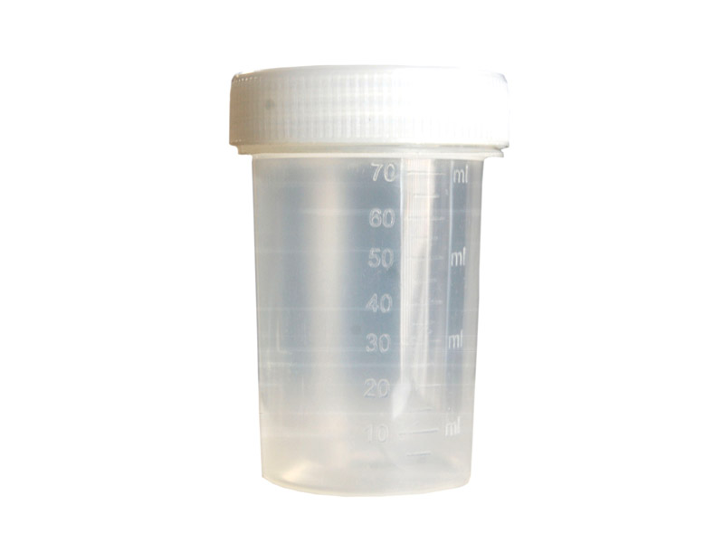 urine culture bottle