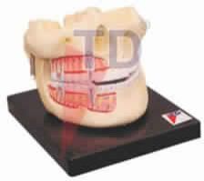Human Upper and Lower Jaw Model