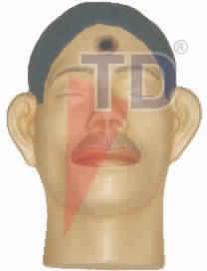 SUICIDAL CONTRACT WOUNDS MODEL