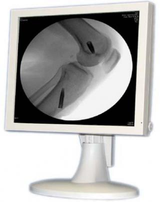 19 Inch Medical Grade Monitor