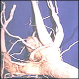 MORINGA TREE ROOTS OR DRUMSTICK TREE ROOTS