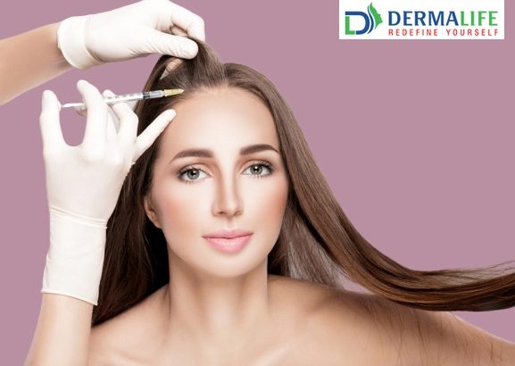 Platelet-rich Plasma Therapy For Hair Loss - Dermalife Clinic - Dermalife  Clinic, Delhi, Delhi