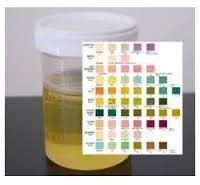 Urine rm test