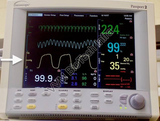 End Tidal Carbon Dioxide Monitor