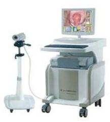 Polished Medical Colposcope, for Clinic, Hospital, Feature : Adjustable, Colposcopy Software