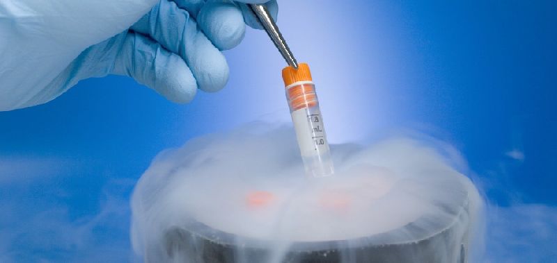 Fertility Cryopreservation Service