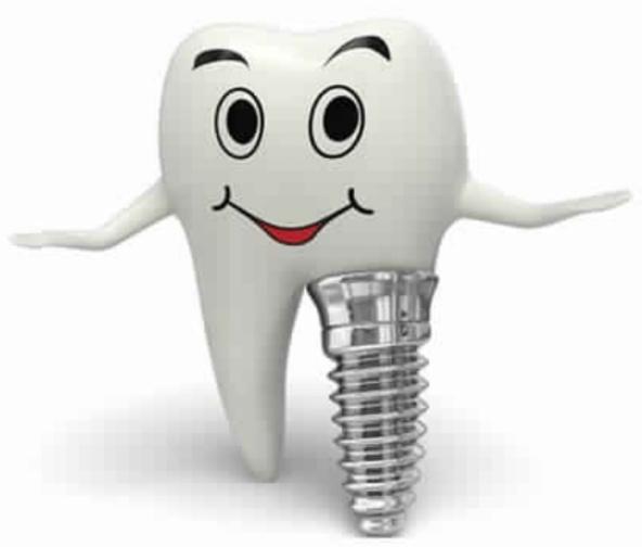 Implant Dentistry