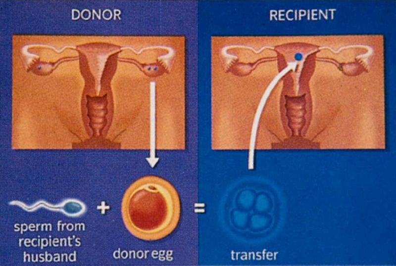 Sperm Donation in Surat