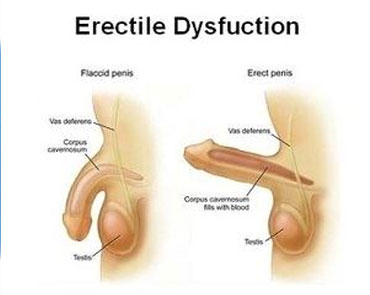 Erectile Dysfunction Treatment Services