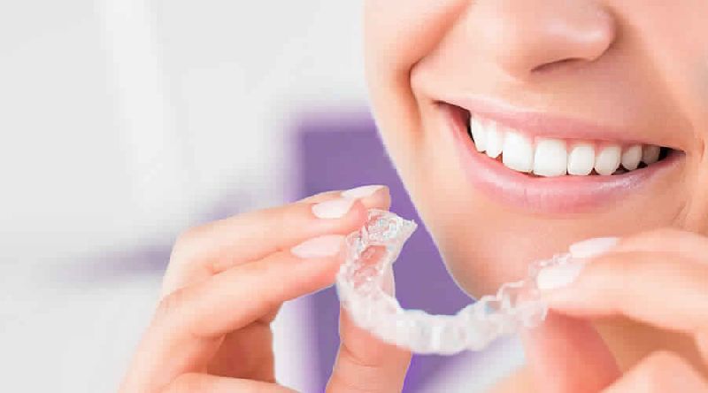 Clear Aligner Treatment Services