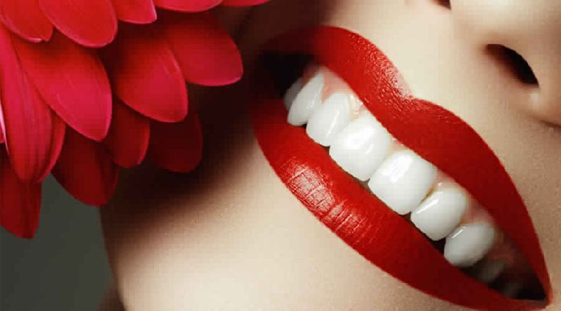 Zoom Teeth Whitening Treatment Services