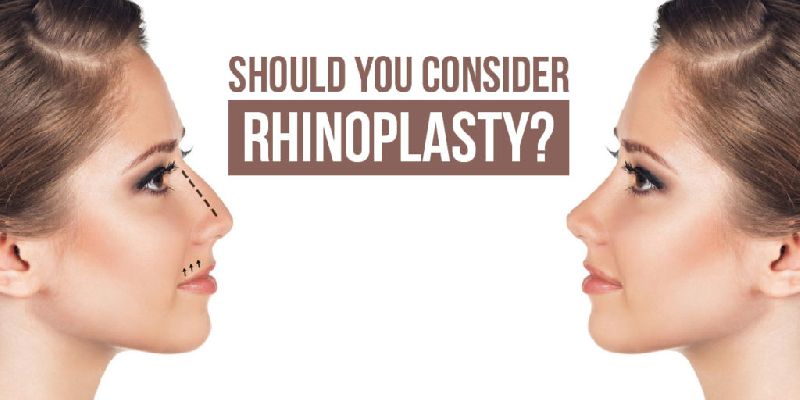 Rhinoplasty Surgery Service