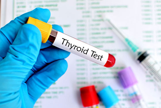 Thyroid Diseases Treatment