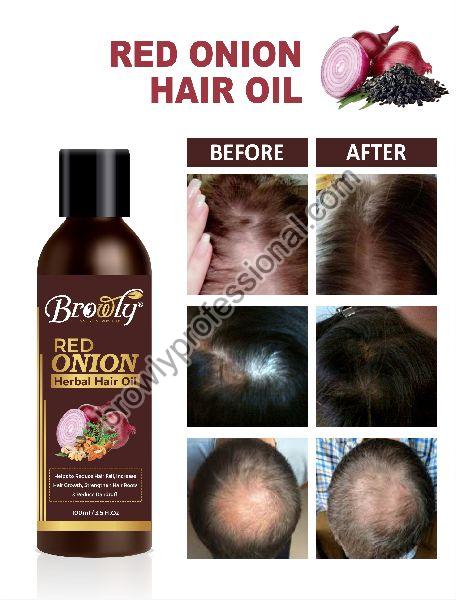 Best Onion Hair Oil - Voxkart.com
