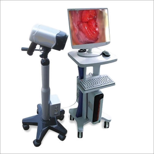 Digital Video Colposcope