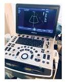 Mindray M8 Elite ultrasound machine