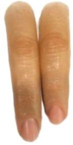 Silicone Finger Prosthesis, Color : Skin Color
