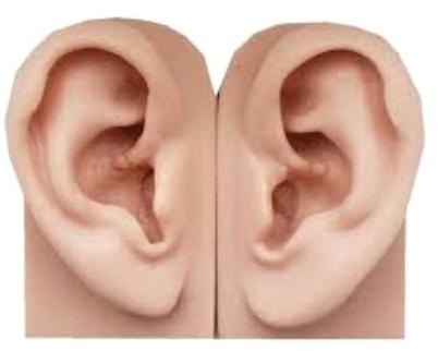 Silicone Ear Prosthesis