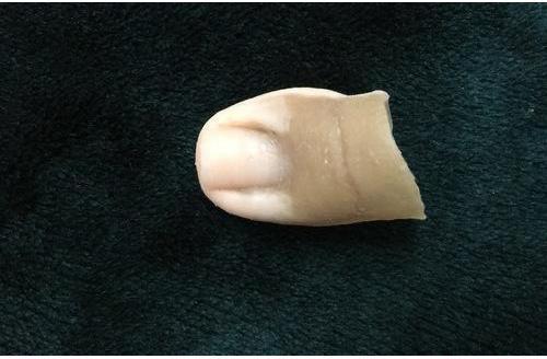 Silicone Toe Prosthesis, Packaging Type : Box