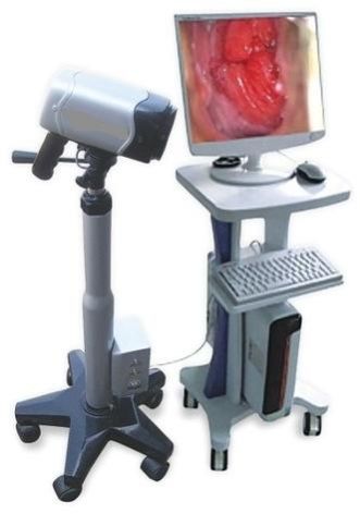 digital colposcope