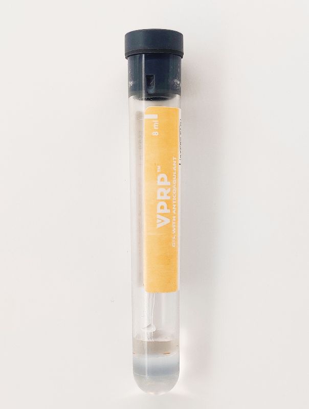 Round VPRP SODIUM CITRATE WITH GEL TUBE, for Hospital, Feature : Disposable, Durable