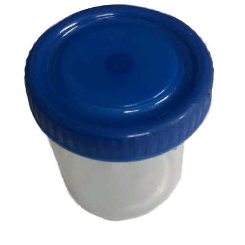 Polypropylene Hospital Urine Container, for Laboratory