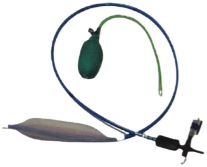 Achalasia Cardia Balloon Dilator (Wire guided), for Hospital use, Feature : Light Weight, flexible