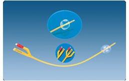 Foley Balloon Catheter