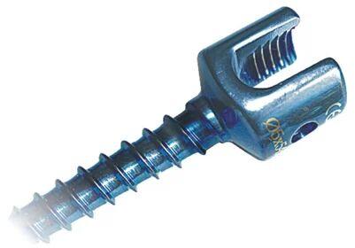 Titanium Sacral Screw, Length : 25-55 mm