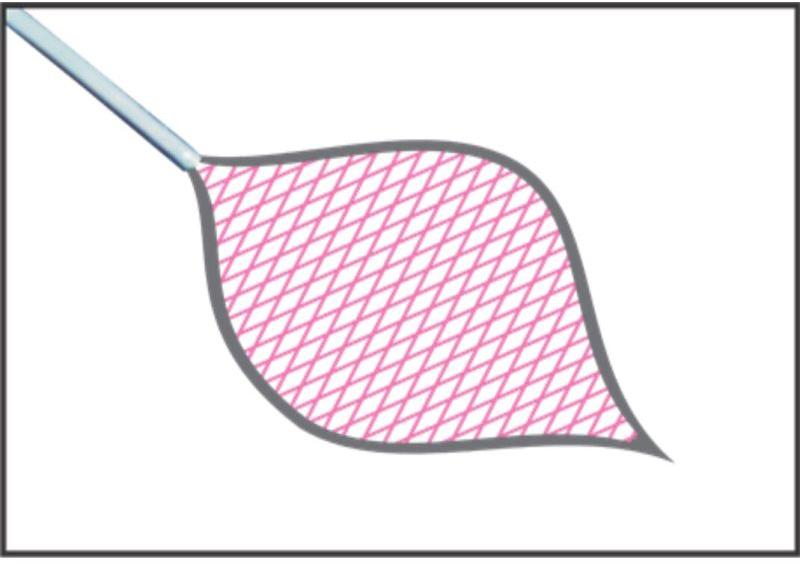 Loop Basket ForEndoscopy