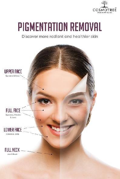 Pigmentation Removal services