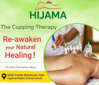 Cupping Therapy Services