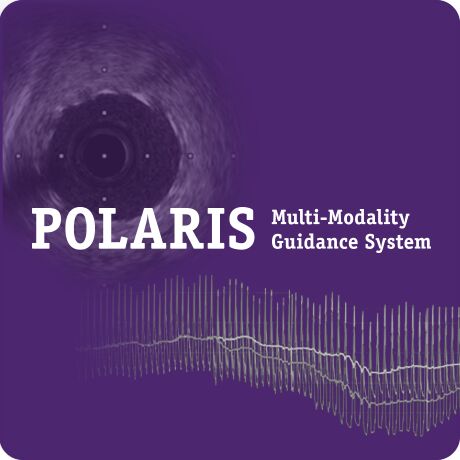 POLARIS System