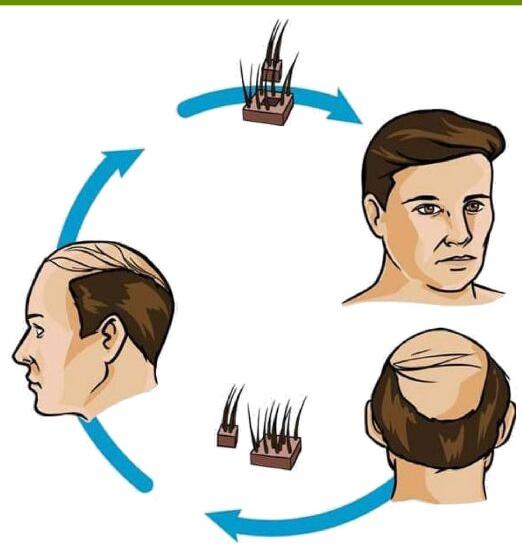 hair transplant cosmetic surgery