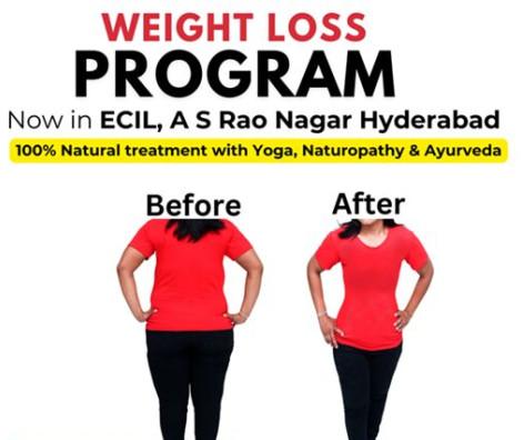 Weight Loss Program, Feature : Natural Naturopathy Therapy