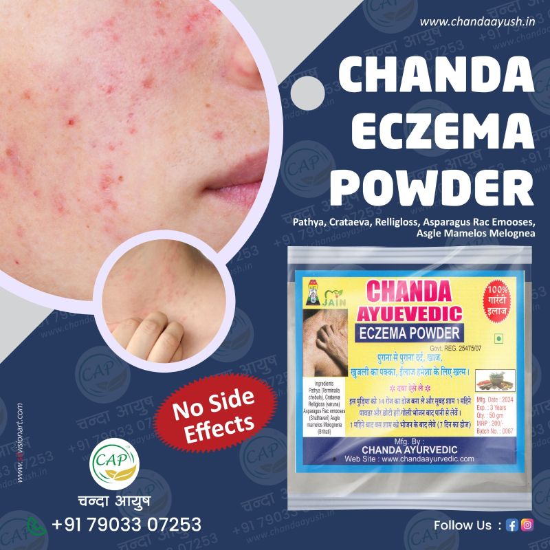 Ytm Eczema Powder