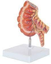 Appendix Circum Model