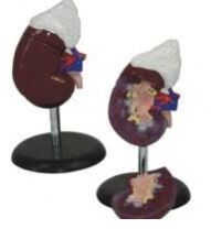 Human Kidney With Adrenal Gland