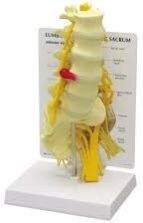 Lumbar Sacrum Herinated Disc Model
