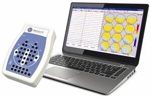 Portable EEG Machine