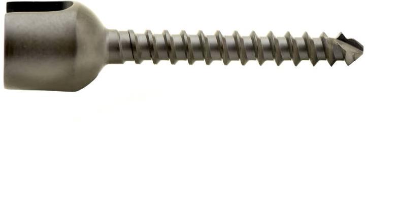 Mono Fenestrated Screw