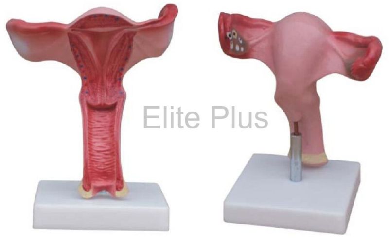 Magnified Uterus Model