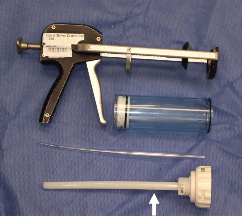 Bone Cement Injector Gun