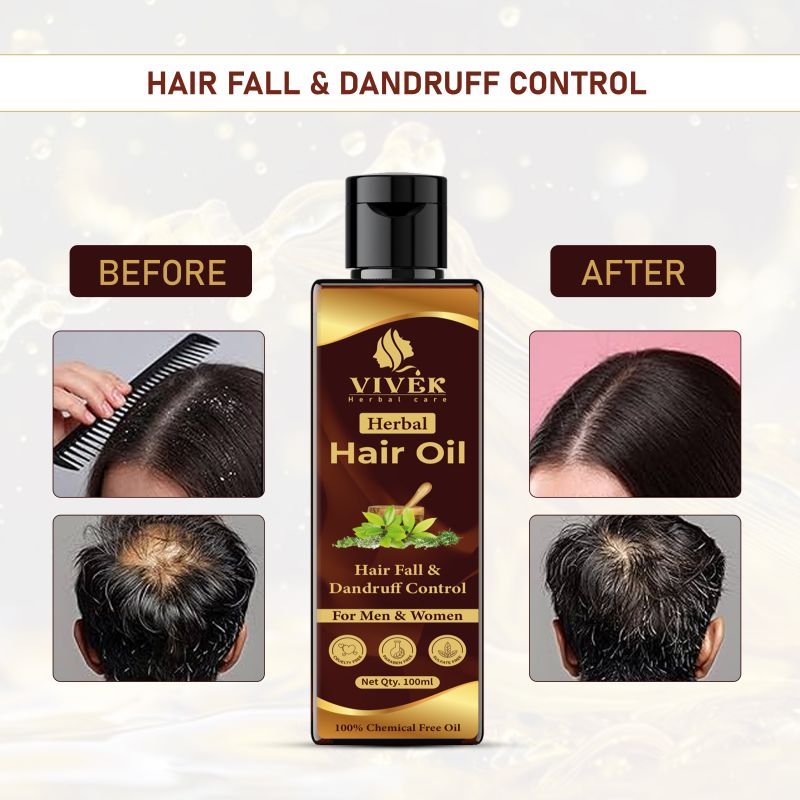 Vivek Anti Dandruff Herbal Hair Oil