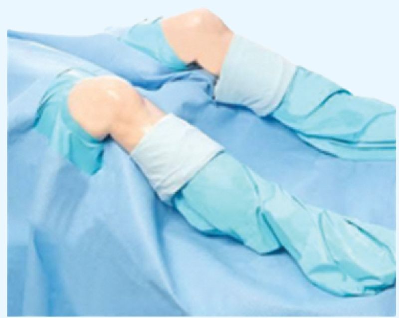 Fixable Drapes Knee Arthroscopy Drape