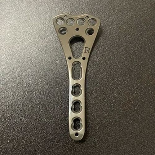 Distal Radius Locking Plate