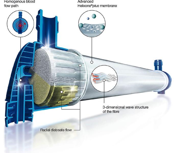 Fresenius Helixone Dialysis Membranes