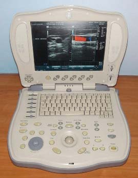 GE Voluson Portable Ultrasound Machine (LOGIQ BOOK XP)