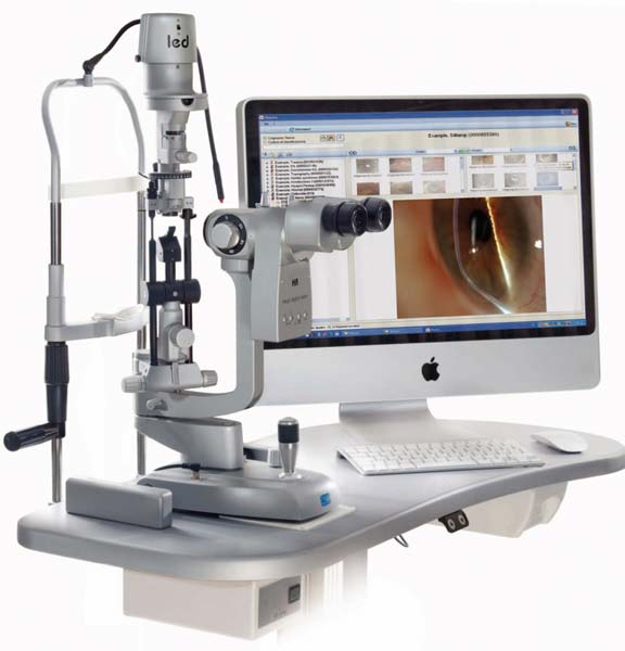 Digital Slit Lamp